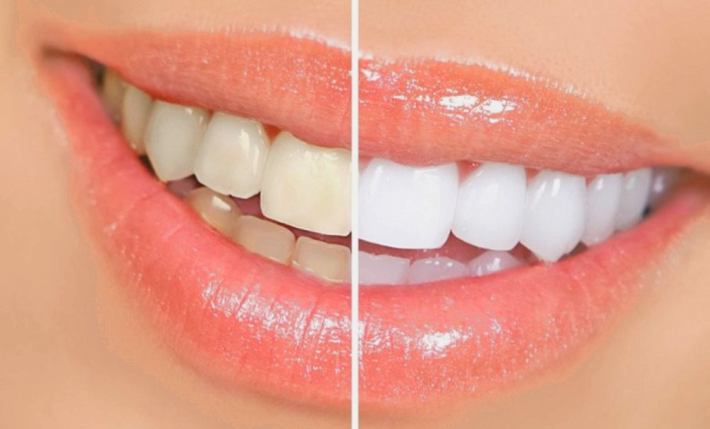 brillant.dental естетична стоматологія